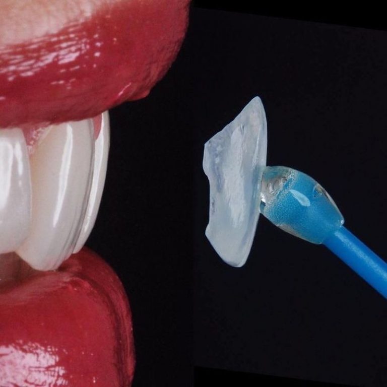 Estetska-stomatologija